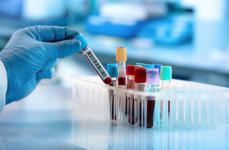 Laboratory Services and Samples - latex gloved hand holds one vial of a blood sample